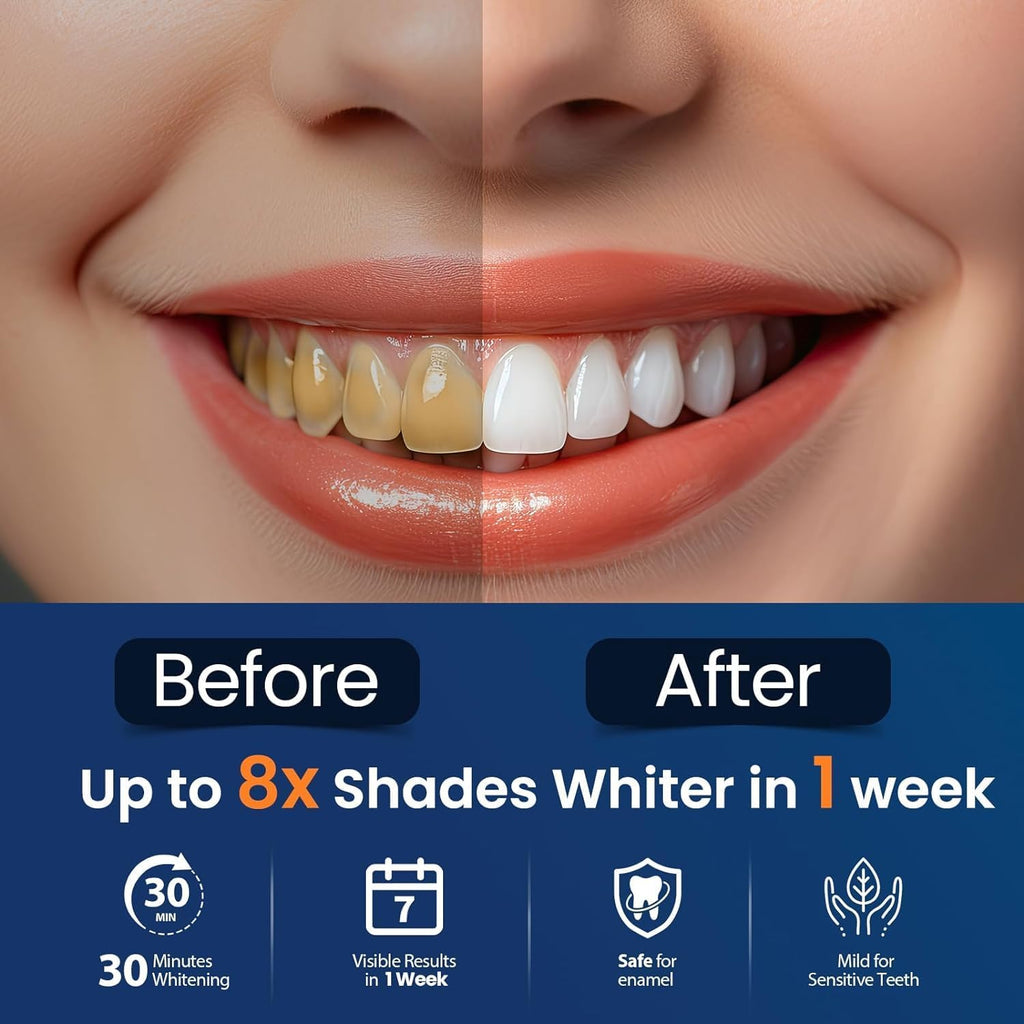 LumaWhite Max - Kit de Blanqueamiento Dental en Casa 5D Whitestrips Efecto Rápido