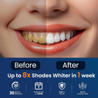 LumaWhite Max - Kit de Blanqueamiento Dental en Casa 5D Whitestrips Efecto Rápido