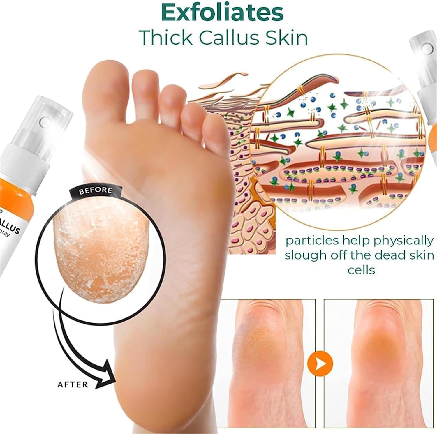 Pies de Seda – Spray Exfoliante e Hidratante