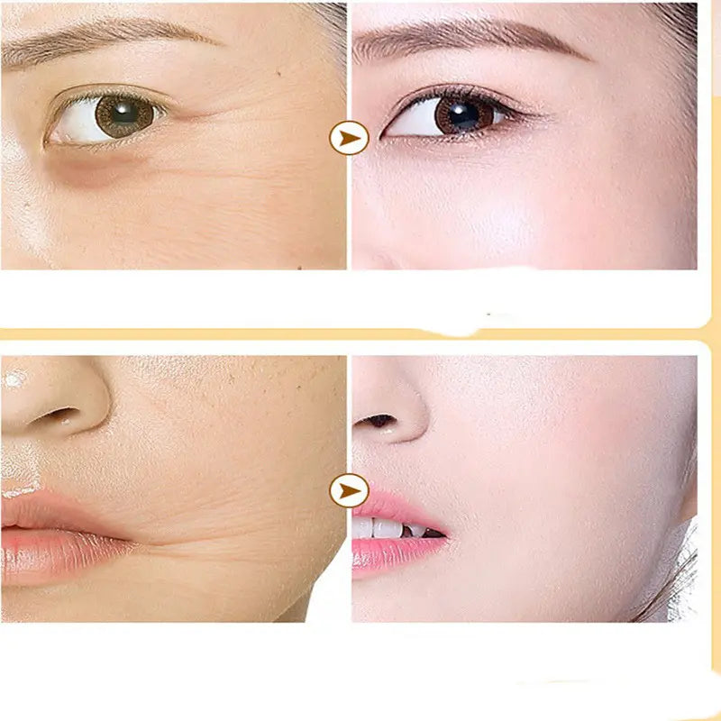 DermaLift Max - Kit de Hilos Tensores de Proteína y Sérum Facial Antiarrugas