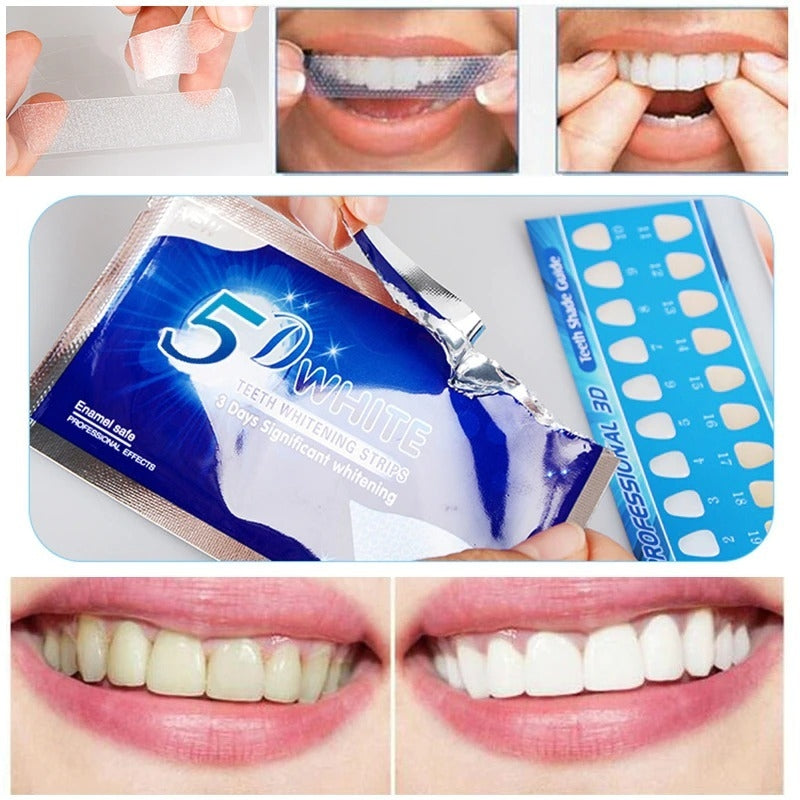 LumaWhite Max - Kit de Blanqueamiento Dental en Casa 5D Whitestrips Efecto Rápido